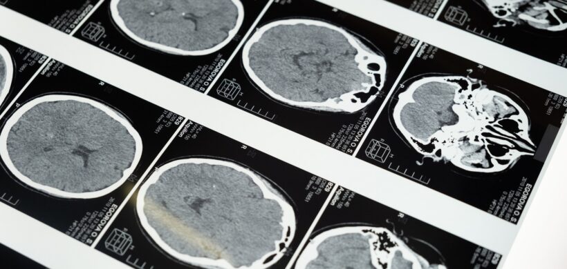 Eje 2: La persona en el centro de la atención sociosanitaria: Prevención, diagnóstico y tratamiento